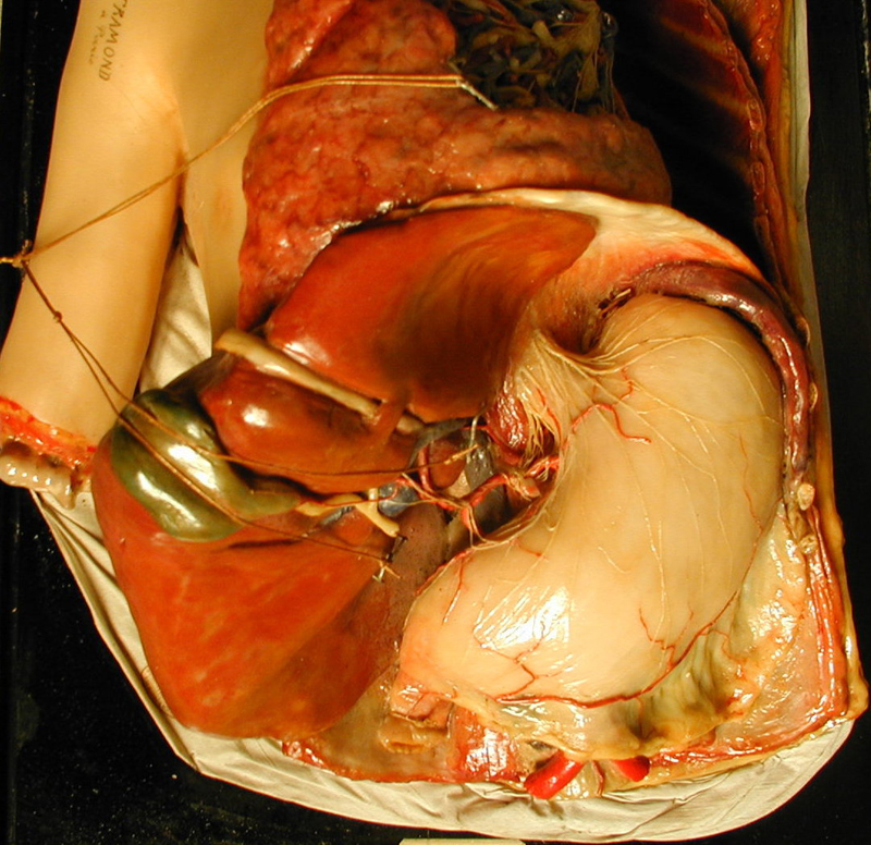 Cire anatomique de l'abdomen