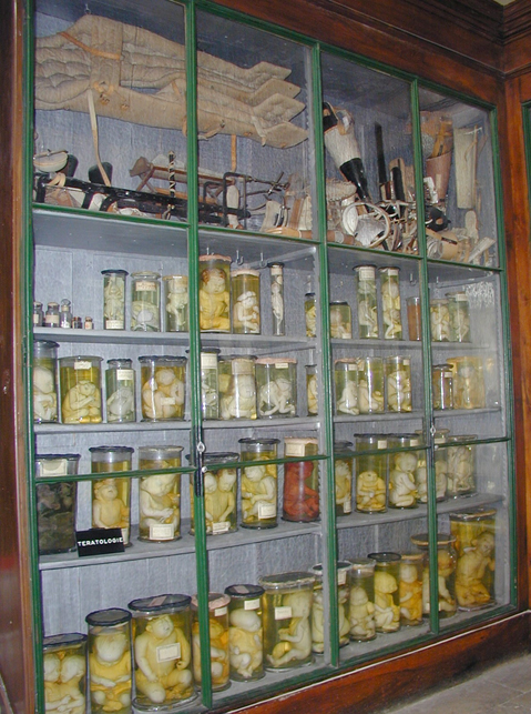 Vitrine de tératologie avec malformations du fœtus